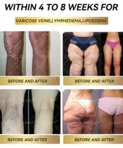 𝗖𝗿𝗼𝗮𝗶𝗲® 𝐆𝐋𝐏-𝟏 𝐌𝐨𝐫𝐢𝐧𝐠𝐚 𝐒𝐥𝐢𝐦𝐦𝐢𝐧𝐠 & 𝐇𝐞𝐚𝐥𝐭𝐡 𝐁𝐨𝐨𝐬𝐭 𝐃𝐫𝐨𝐩𝐬