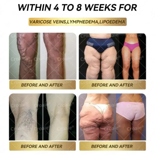 𝗖𝗿𝗼𝗮𝗶𝗲® 𝐆𝐋𝐏-𝟏 𝐌𝐨𝐫𝐢𝐧𝐠𝐚 𝐒𝐥𝐢𝐦𝐦𝐢𝐧𝐠 & 𝐇𝐞𝐚𝐥𝐭𝐡 𝐁𝐨𝐨𝐬𝐭 𝐃𝐫𝐨𝐩𝐬