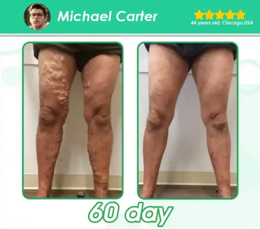 𝑪𝒓𝐨𝒂𝗶𝗲® 𝐆 𝐋 𝐏-𝟏 𝗠𝗲𝘁𝗮𝗯𝗼𝗹𝗶𝗰 Support – 𝗨𝗹𝘁𝗿𝗮 𝗖𝗼𝗻𝗰𝗲𝗻𝘁𝗿𝗮𝘁𝗲𝗱 𝗟𝗶𝗾𝘂𝗶𝗱 𝗣𝗲𝗮𝗿𝗹𝘀 𝘄𝗶𝘁𝗵 𝗡𝗔𝗗+, 𝗠𝗼𝗿𝗶𝗻𝗴𝗮 & 𝗔𝗖𝗩 – 𝗔𝗽𝗽𝗲𝘁𝗶𝘁𝗲 𝗖𝗼𝗻𝘁𝗿𝗼𝗹, 𝗪𝗲𝗶𝗴𝗵𝘁 𝗠𝗮𝗻𝗮𝗴𝗲𝗺𝗲𝗻𝘁 & 𝗖𝗮𝗿𝗱𝗶𝗼𝘃𝗮𝘀𝗰𝘂𝗹𝗮𝗿 𝗦𝘂𝗽𝗽𝗼𝗿𝘁