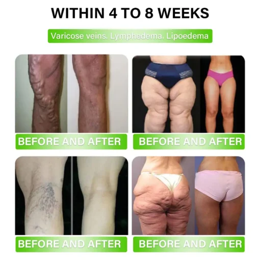 𝑪𝒓𝐨𝒂𝗶𝗲® 𝐆 𝐋 𝐏-𝟏 𝗠𝗲𝘁𝗮𝗯𝗼𝗹𝗶𝗰 Support – 𝗨𝗹𝘁𝗿𝗮 𝗖𝗼𝗻𝗰𝗲𝗻𝘁𝗿𝗮𝘁𝗲𝗱 𝗟𝗶𝗾𝘂𝗶𝗱 𝗣𝗲𝗮𝗿𝗹𝘀 𝘄𝗶𝘁𝗵 𝗡𝗔𝗗+, 𝗠𝗼𝗿𝗶𝗻𝗴𝗮 & 𝗔𝗖𝗩 – 𝗔𝗽𝗽𝗲𝘁𝗶𝘁𝗲 𝗖𝗼𝗻𝘁𝗿𝗼𝗹, 𝗪𝗲𝗶𝗴𝗵𝘁 𝗠𝗮𝗻𝗮𝗴𝗲𝗺𝗲𝗻𝘁 & 𝗖𝗮𝗿𝗱𝗶𝗼𝘃𝗮𝘀𝗰𝘂𝗹𝗮𝗿 𝗦𝘂𝗽𝗽𝗼𝗿𝘁