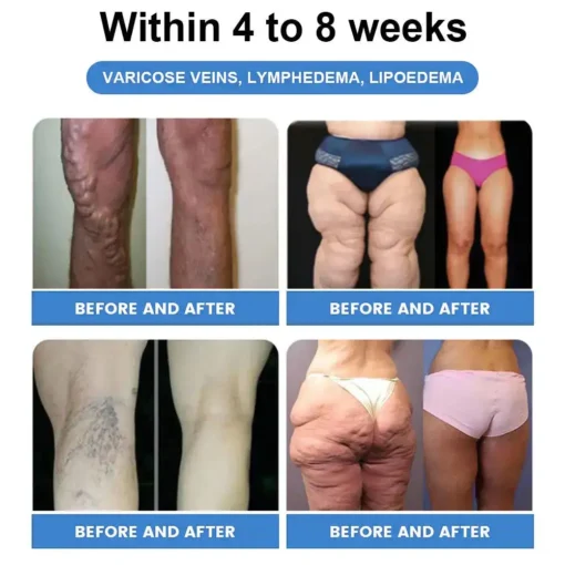 𝐶𝑅𝑂𝐴𝐼𝐸® 𝐺𝐿𝑃-1 SLIMMING & HEALTH BOOST DROPS