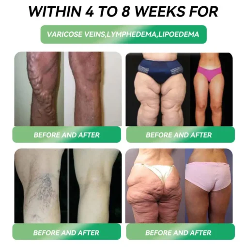Croaie® GLP-1 Weight Loss Liquid Gel