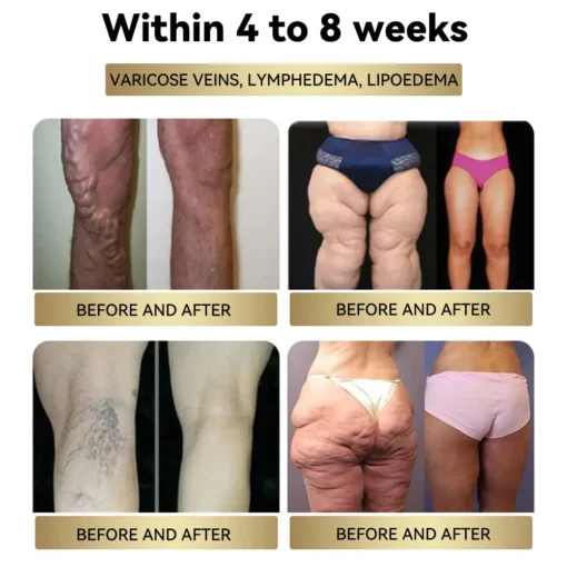 Croaie® NIDDK Tirzepatide Cyclic Peptide Thermo Slim Cream