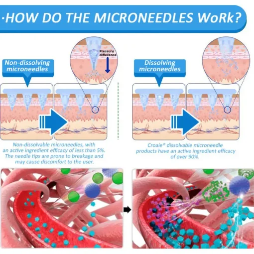 Croaie® Nano Microneedle Patch with SMGT-GLP-1 & Matrixyl 3000