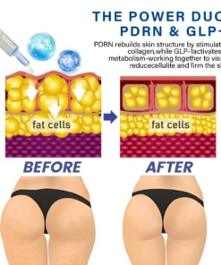 𝐂𝐫𝐨𝐚𝐢𝐞® 𝐏𝐃𝐑𝐍-𝐆𝐋𝐏-𝟏 𝐒𝐥𝐢𝐦𝐦𝐢𝐧𝐠 & 𝐁𝐥𝐨𝐨𝐝 𝐒𝐮𝐠𝐚𝐫 𝐑𝐞𝐠𝐮𝐥𝐚𝐭𝐢𝐧𝐠 𝐑𝐞𝐞𝐝𝐥𝐞 𝐒𝐡𝐨𝐭 𝐒𝐞𝐫𝐮𝐦