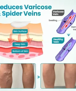 Croaie® VeinAway Relief Cream