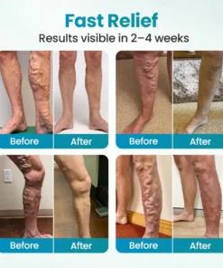 Croaie® VeinAway Relief Cream