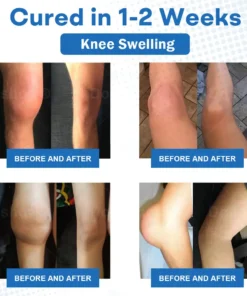 𝐂𝐫𝐨𝐚𝐢𝐞® 𝐀𝐝𝐯𝐚𝐧𝐜𝐞𝐝 𝐌𝐚𝐠𝐧𝐞𝐬𝐢𝐮𝐦 𝐏𝐚𝐢𝐧 𝐑𝐞𝐥𝐢𝐞𝐟 𝐂𝐫𝐞𝐚𝐦