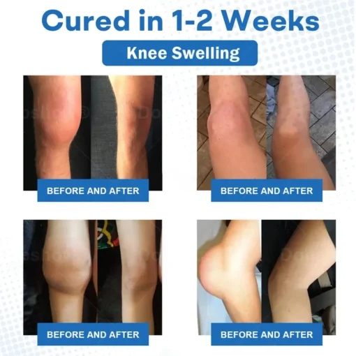 𝐂𝐫𝐨𝐚𝐢𝐞® 𝐀𝐝𝐯𝐚𝐧𝐜𝐞𝐝 𝐌𝐚𝐠𝐧𝐞𝐬𝐢𝐮𝐦 𝐏𝐚𝐢𝐧 𝐑𝐞𝐥𝐢𝐞𝐟 𝐂𝐫𝐞𝐚𝐦