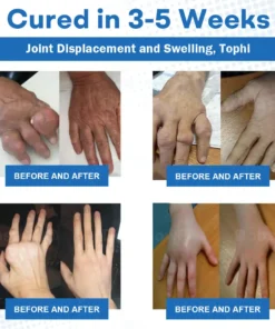 𝐂𝐫𝐨𝐚𝐢𝐞® 𝐀𝐝𝐯𝐚𝐧𝐜𝐞𝐝 𝐌𝐚𝐠𝐧𝐞𝐬𝐢𝐮𝐦 𝐏𝐚𝐢𝐧 𝐑𝐞𝐥𝐢𝐞𝐟 𝐂𝐫𝐞𝐚𝐦