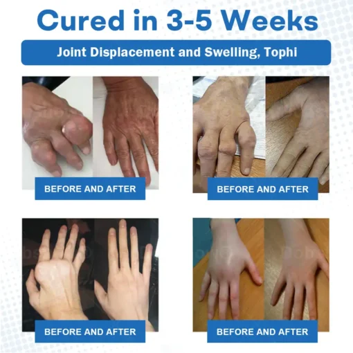 𝐂𝐫𝐨𝐚𝐢𝐞® 𝐀𝐝𝐯𝐚𝐧𝐜𝐞𝐝 𝐌𝐚𝐠𝐧𝐞𝐬𝐢𝐮𝐦 𝐏𝐚𝐢𝐧 𝐑𝐞𝐥𝐢𝐞𝐟 𝐂𝐫𝐞𝐚𝐦