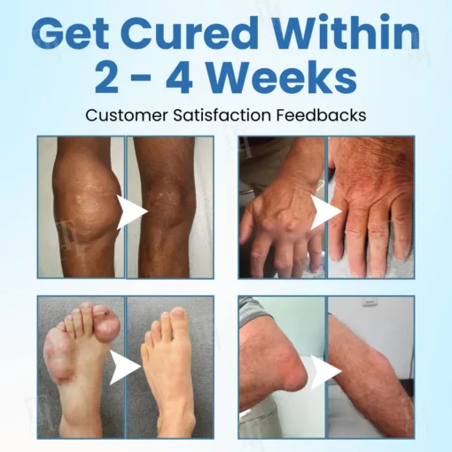 Croaie® EnduraHeal Magnesium Pain Relief Cream