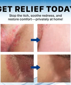 Croaie® Scrotum Itchy Treatment Cream