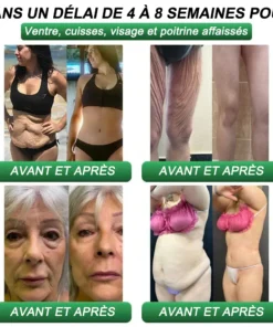 CROAIE® Gouttes Minceur & Santé GLP-1 & Matrixyl 3000