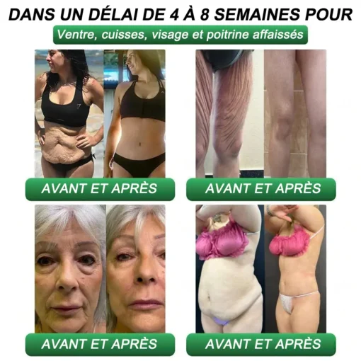 CROAIE® Gouttes Minceur & Santé GLP-1 & Matrixyl 3000