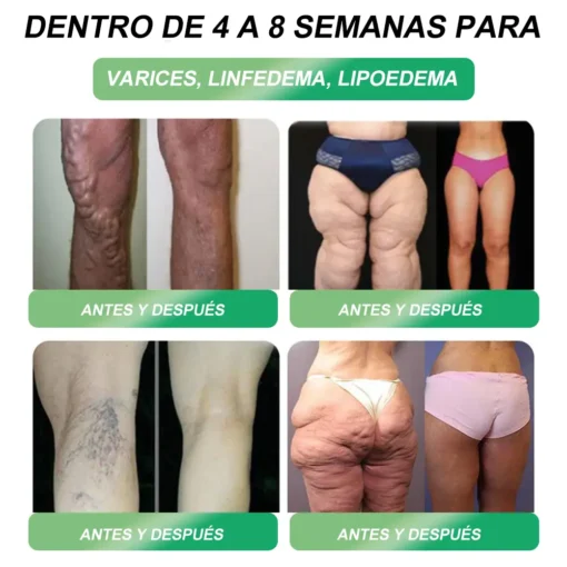Croaie® 𝐆𝐋𝐏-𝟏 𝑺𝑰𝑿-𝑰𝑵-𝑶𝑵𝑬 𝑯𝒆𝒂𝒍𝒕𝒉 𝑺𝒐𝒍𝒖𝒕𝒊𝒐𝒏 𝑶𝒓𝒂𝒍 𝑳𝒊𝒒𝒖𝒊𝒅