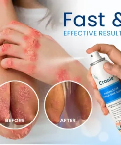 Croaie® Magnesium Herbal Skin Spray