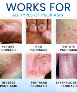 Croaie® Magnesium Herbal Skin Spray