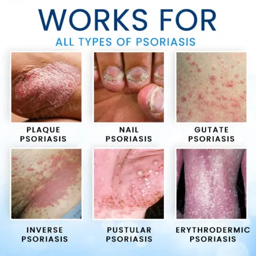 Croaie® Magnesium Herbal Skin Spray