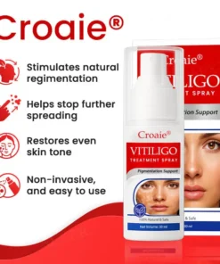 Croaie® Vitiligo Treatment Spray