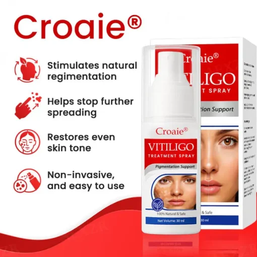 Croaie® Vitiligo Treatment Spray