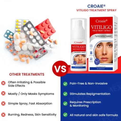 Croaie® Vitiligo Treatment Spray