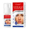 Croaie® Vitiligo Treatment Spray
