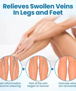 Croaie® VenoEase Herbal Spray