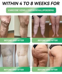 Croeie® Telportide Oral Solution