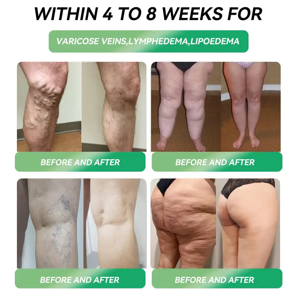 Croeie® Telportide Oral Solution