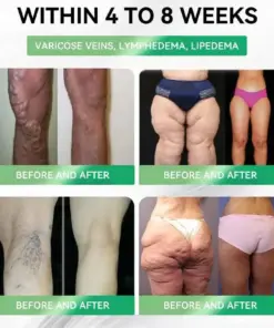 Croaieยฎ ๐๐๐ฃ-๐ญ ๐๐-๐ข๐ง-๐ ๐๐ฅ๐ข๐ฆ & ๐๐๐๐ฅ๐ญ๐ก ๐๐ซ๐๐ฅ ๐๐จ๐ฅ๐ฎ๐ญ๐ข๐จ๐ง