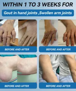 Croaie® ʙ.ᴘ.ᴄ-157 Joint Healing Cream