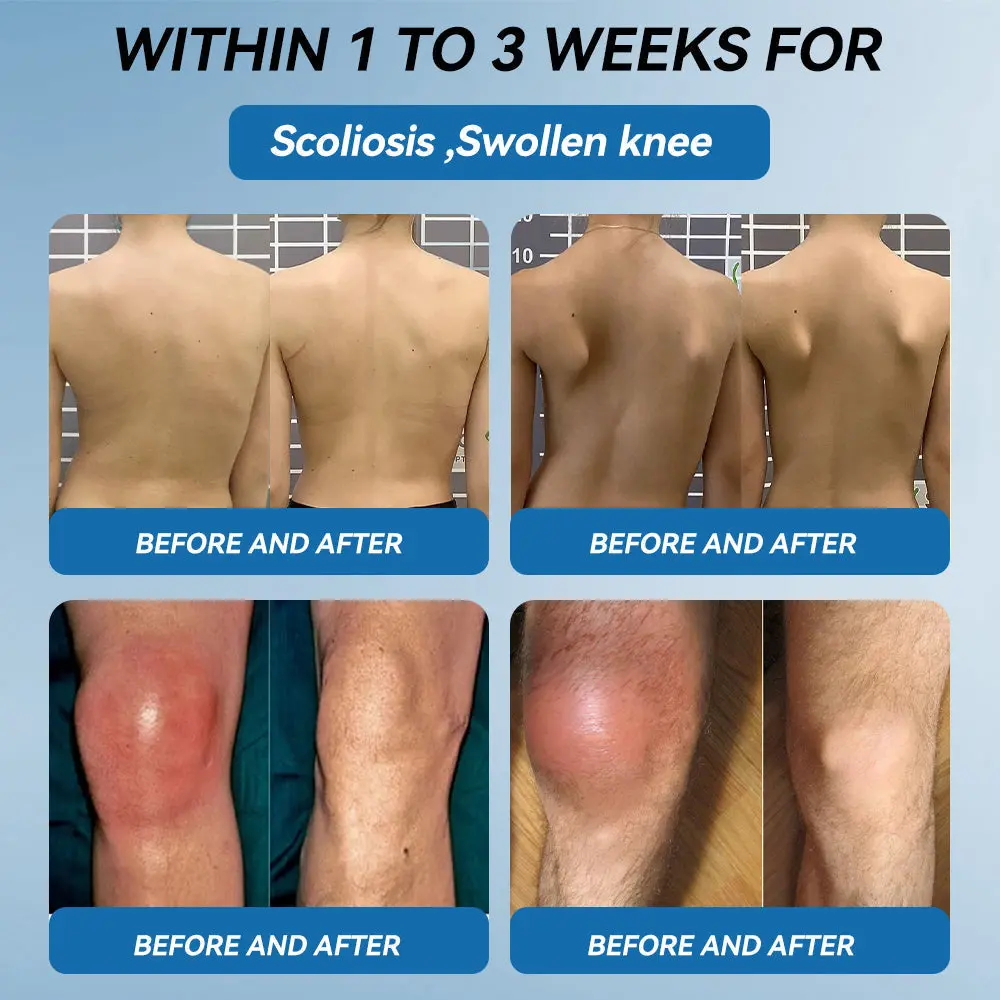 Croaie® ʙ.ᴘ.ᴄ-157 Joint Healing Cream