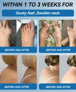 Croaie® ʙ.ᴘ.ᴄ-157 Joint Healing Cream