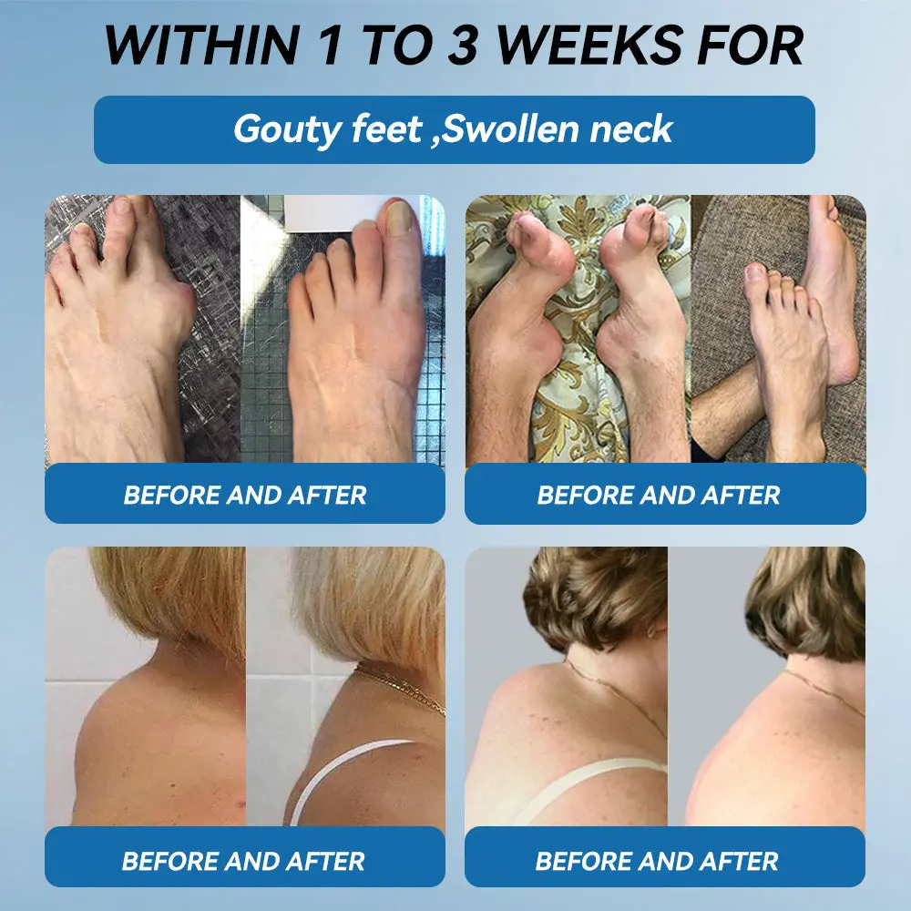 Croaie® ʙ.ᴘ.ᴄ-157 Joint Healing Cream