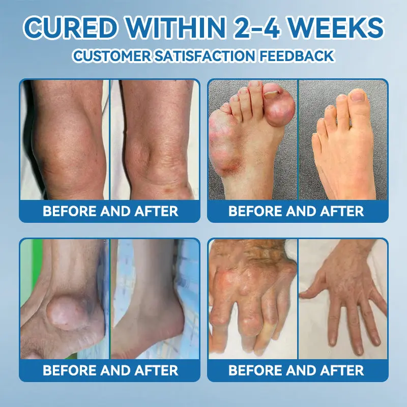 Croaie® ʙ.ᴘ.ᴄ-157 Joint Healing Cream