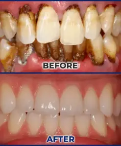 Croaie® ApiGuard BeeVenom Therapeutic Oral Drops & Rinse