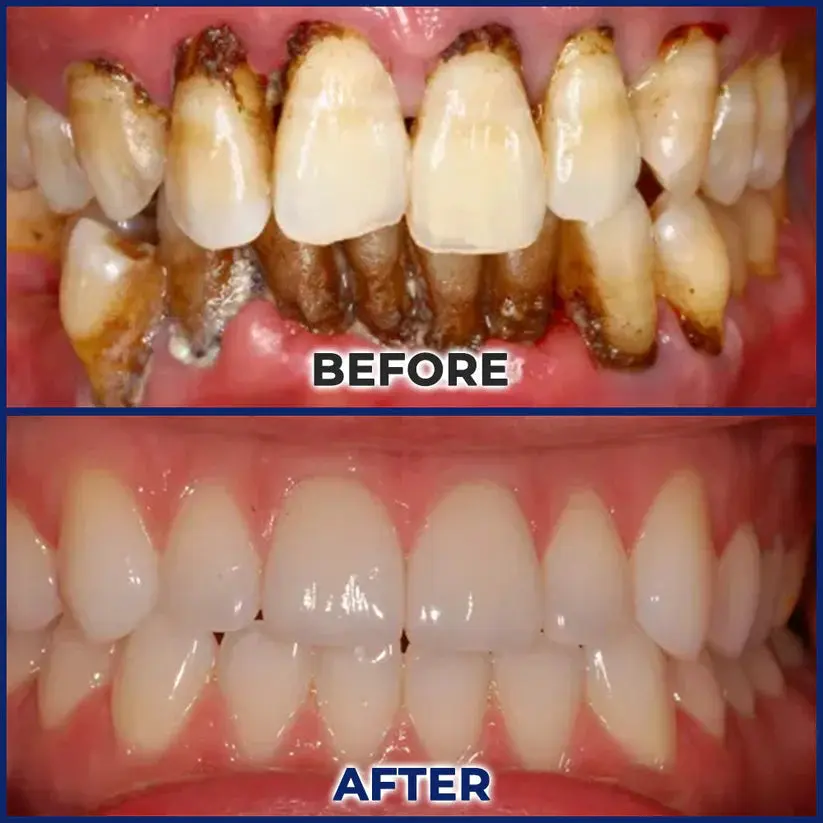 Croaie® ApiGuard BeeVenom Therapeutic Oral Drops & Rinse