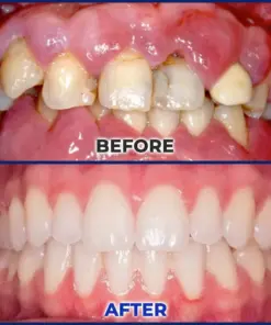 Croaie® ApiGuard BeeVenom Therapeutic Oral Drops & Rinse