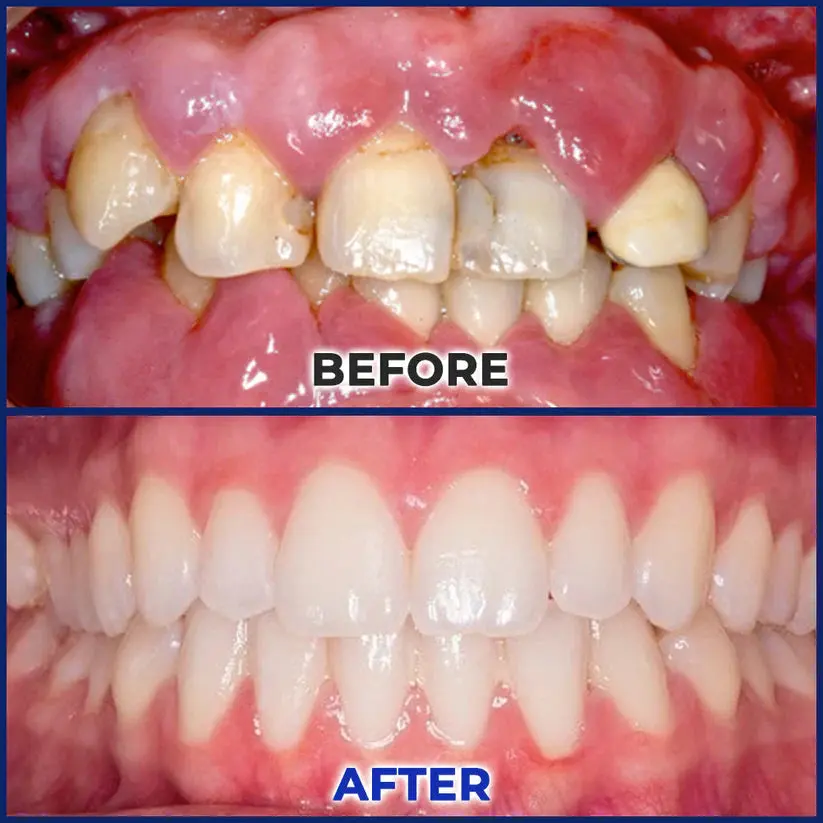 Croaie® ApiGuard BeeVenom Therapeutic Oral Drops & Rinse