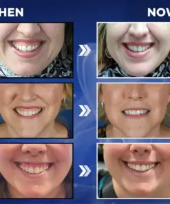 Croaie® ApiGuard BeeVenom Therapeutic Oral Drops & Rinse