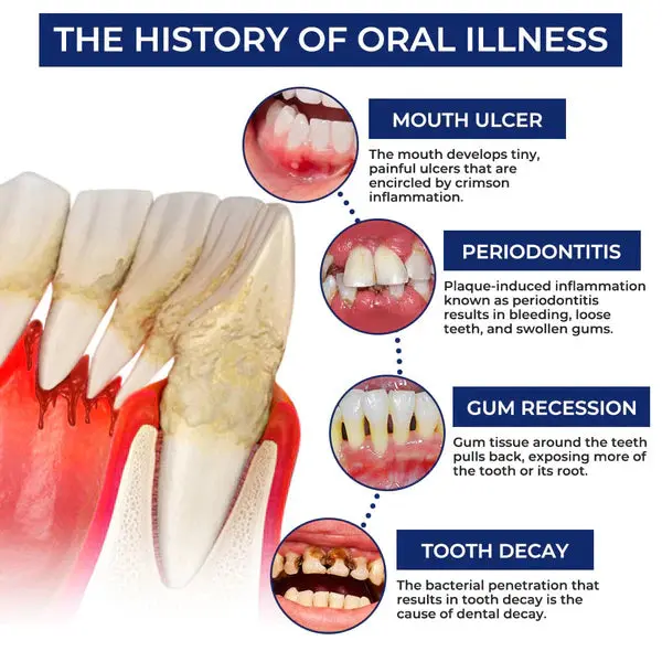 Croaie® ApiGuard BeeVenom Therapeutic Oral Drops & Rinse
