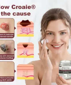 Croaie® Blemish Erase Pro Wart Removal Cream