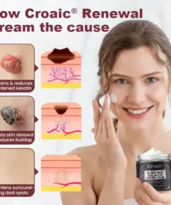 Croaie® KeraErase RICEDUAL-ACTION RENEWAL CREAM