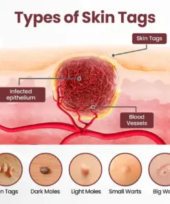 Croaie® KeraErase RICEDUAL-ACTION RENEWAL CREAM