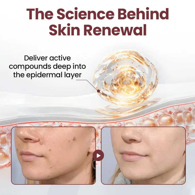 Croaie® KeraErase RICEDUAL-ACTION RENEWAL CREAM