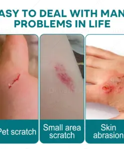 Croaie® SKINSHIELD QUICKDRYING LIQUID BANDAGE