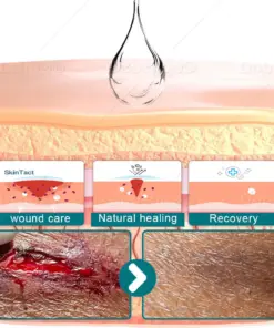 Croaie® SKINSHIELD QUICKDRYING LIQUID BANDAGE