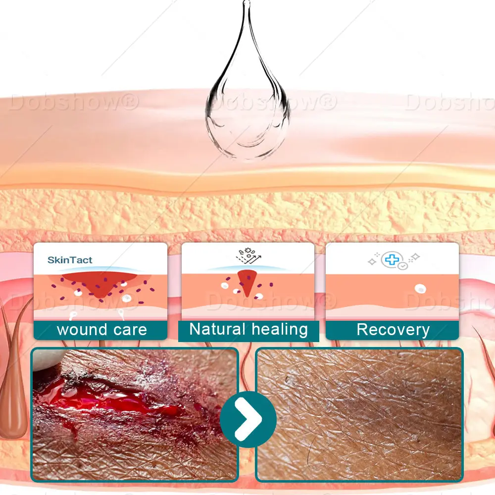 Croaie® SKINSHIELD QUICKDRYING LIQUID BANDAGE