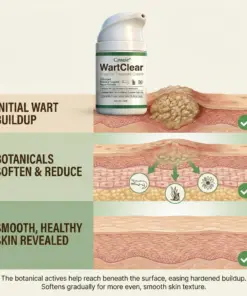 Croaie® WartClear Botanical Treatment Cream